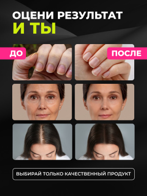 1WIN / Биотин 5000 мкг, 180 капсул